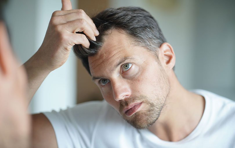 Hair Loss